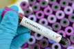 На Тернопільщині вже 9 людей померли від ускладнень коронавірусу