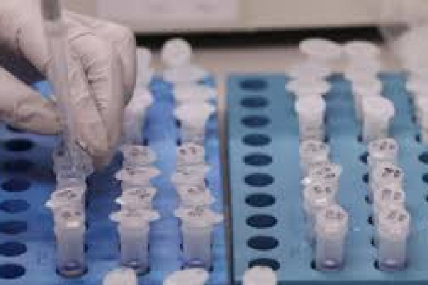 На Тернопільщині масово тестуватимуть людей на імунітет до COVID-19