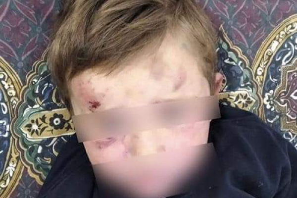 На Тернопільщині чоловік побив свого чотирирічного пасинка: дитину госпіталізували