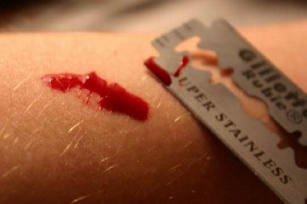 Порізав вени на руках: у Тернополі чоловік намагався покінчити життя самогубством