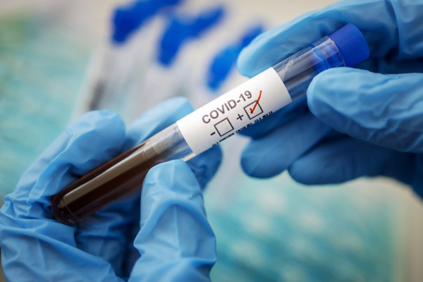 Знову коронавірус: пів сотні випадків ковіду зафіксували за минулу добу на Тернопільщині