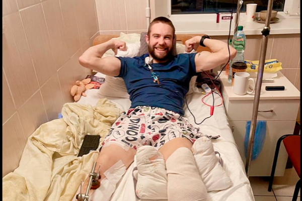 Лікарям не вдалося врятувати ногу пораненому захиснику з Тернополя